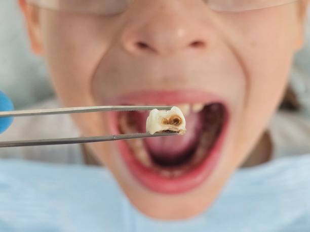 Best Emergency Broken Tooth Repair in Kenhorst, PA