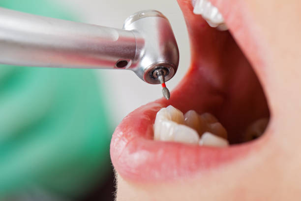 Best Emergency Broken Tooth Repair in Kenhorst, PA